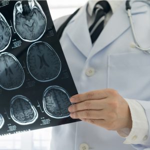 Medical professional looking over MRI